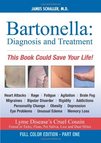 Bartonella: Diagnosis and Treatment: Part 1 of 2, Full Color Edition